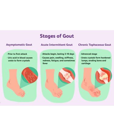 MediMad Uric Acid Gout Urine Test Strips GP/Pro Use CE Marked - Buy Online on GoSupps.com