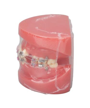 Verdant Touch Orthodontic Demonstration Model Orthodontic Dental Model Dissected Resin Teeth Model for Teaching Research