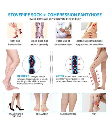 Yisemeya 2XL Medical Compression Stockings for Women - 20-30 mmHg Support for Varicose Veins & Edema | Long Tights for Ultimate Comfort - Buy Online on GoSupps.com