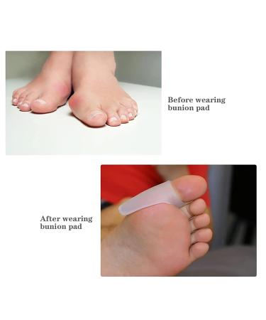Gel Bunion Protector Shield - 4PCS Bunion Pads & Cushions for Big Toe - Foot Guard for Friction & Pressure - Transparent, One Size - Buy Online on GoSupps.com