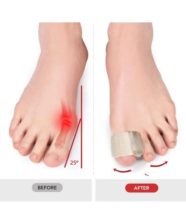 6 Pairs Elastic Toe Separator Spacers - Soft Toe Corrector for Hammertoes, Bunions, and Sports - Buy Online on GoSupps.com