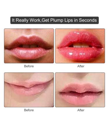 Lip Enhancer Plumper Tool - Natural Lips Enlarger Suction Lip Enhancement Beauty Tool for Women - Buy Online on GoSupps.com