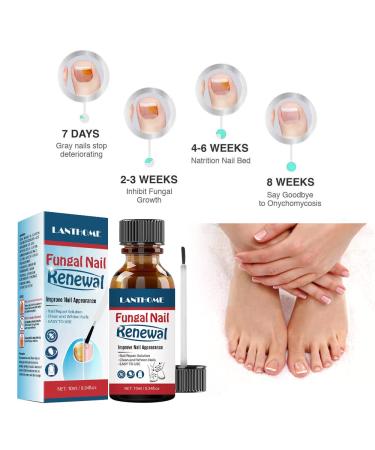 Repair Essence Liquid for Fingernail and Toenail | Fix & Renew Damaged Nails | Reduce Thickening & Strengthen for Beautiful Nails - Buy Online on GoSupps.com