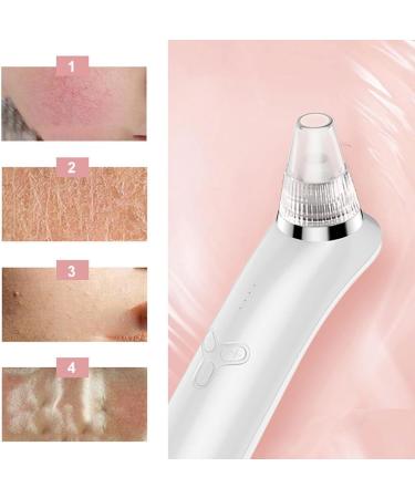 USB Rechargeable Blackhead Remover Electric Pore Cleaner Tool Extractor for Blackheads - Buy Online on GoSupps.com