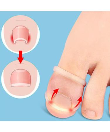 Professional Silicone Ingrown Toenail Corrector Tool Paronychia Treatment Corrector 10 Piece Set Fast Relief from Discomfort and Secure Recovery - Buy Online on GoSupps.com