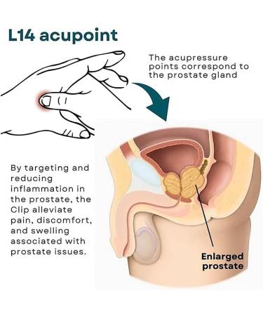Prostate Care Point Clip L14 Acupressure Point Clips Migraine Pressure Point Clip Acupressure Hand Pressure Point Clip Promotes Blood Circulation Long-Lasting and Reusable (4pcs) - Buy Online on GoSupps.com