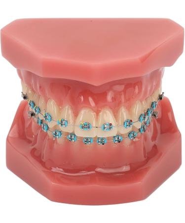 Typodont Orthodontic Tooth Model (28 Teeth) - Realistic Crowded Teeth & Malocclusion Representation for Dental Education & Practice - Buy Online on GoSupps.com