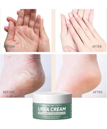 Urea Foot Cream 40% Cracked Heel Repair Cream Urea Cream For Cracked Heels and Dry Skin Foot Care Intensive Moisturizer Heel Balm For Cracked Heel Softens Feet & Hand & Knee Relieve Foot Pain-120g - Buy Online on GoSupps.com