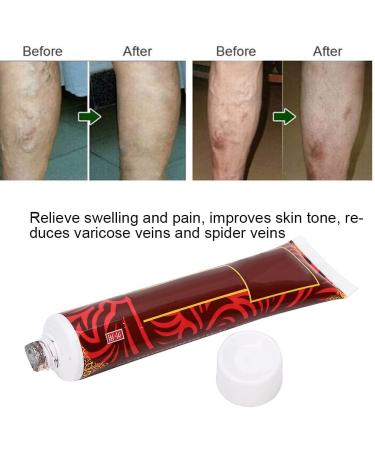Vein Cream - Mild Massage Ointment for Tired Heavy Legs | International Shipping - Buy Online on GoSupps.com