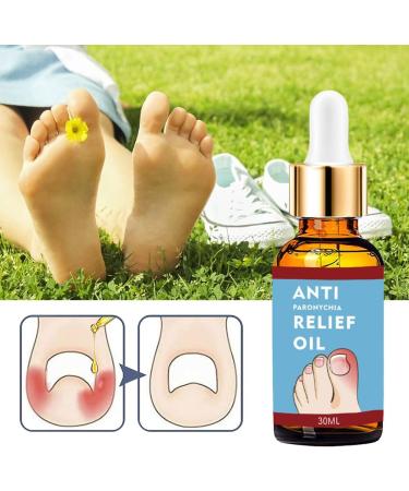 Ingrown Toenail Treatment Ingrown Toenail Treatment Drop Toenail Anti Paronychia Relief Oil Fungal Nail Treatment for Toenails Ingrown Toenail Treatment Nail Growth Treatment Nail Care (30ML) - Buy Online on GoSupps.com