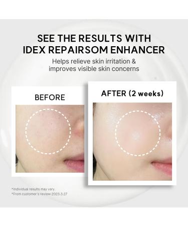 Ph. Hubby IDEX Repairsom Enhancer Soothing & Barrier-Strengthening Skin Recovery Ampoule Non-Irritating Serum with Ixiridium Dentatum Extract and Peptide Complex 15ml - Buy Online on GoSupps.com