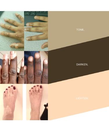 Fake Bake Vitiligo Vanquish Camouflage Kit - Long Lasting Concealer for Skin Depigmentation - Natural Color Customization for Women & Men - Buy Online on GoSupps.com