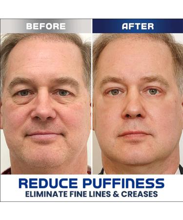 Openeyes Awaken Peptide Lifting Eye Gel for Men - 5Pcs | Reduce Fine Lines, Dark Circles & Wrinkles | Retinol Eye Cream for Anti-Aging & Depuffing - Buy Online on GoSupps.com