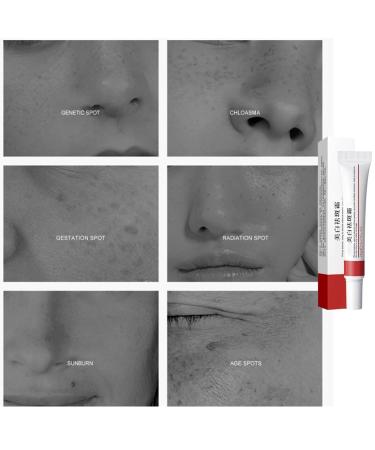 Buy Achromin & Pigmanorm Creams | Best Multi-Purpose Face Moisturizer for Brightening & Hydration - International Shipping Available - Buy Online on GoSupps.com