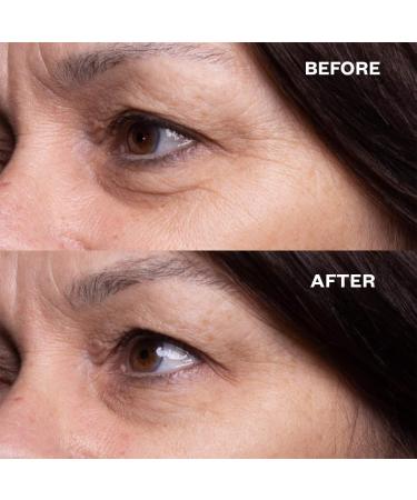 Wrinkles Schminkles Eye & Mouth Lift Set - Under Eye and Lip Wrinkle Patches - Buy Online on GoSupps.com