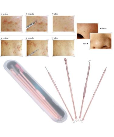 4-Piece Blackhead Remover Kit | Stainless Steel Acne Removal Tools & Comedon Extractor | Pimple Treatment Set - Buy Online on GoSupps.com
