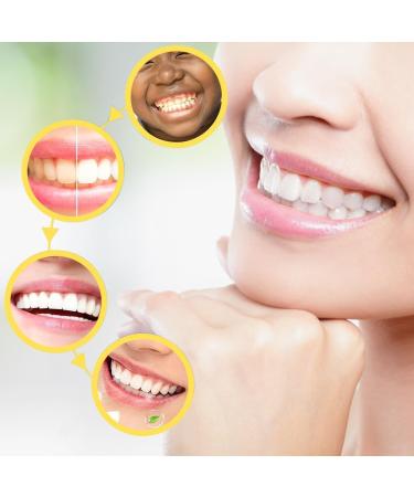 BYXG Dental Floss Holder - 2 Pack Dental Floss Fork for Effective Teeth Cleaning | International Shipping Available - Buy Online on GoSupps.com