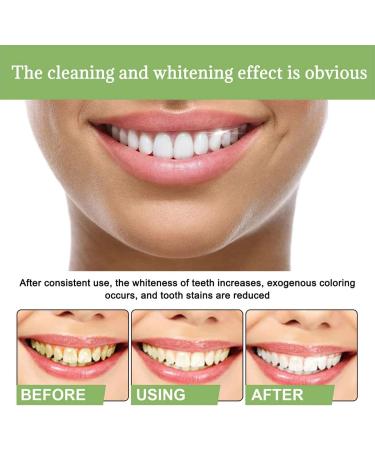 Ampoule Essence Toothpaste Teeth Whitening Essence Tooth Stain Remover Fresh Breath Suitable for Daily Use - Buy Online on GoSupps.com