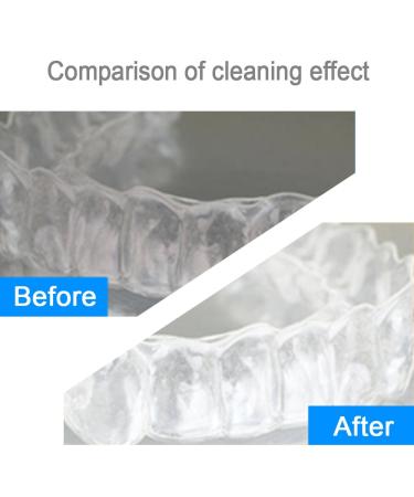 Elera Sonic Cordless Retainer & Denture Cleaner Machine | Premium Jewelry & Coins Cleaning - Buy Online on GoSupps.com