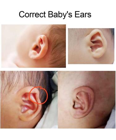 JUOPZKENN Kids Auricle Valgus Reform Patch | Ear Aesthetic Corrector for Newborns | Protruding Ear Stick-on Sticker 4x50cm - Buy Online on GoSupps.com