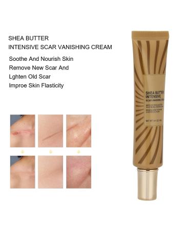 Scar Removal Cream 40g - Non-Oily Formula for Face & Body | Stretch Marks, Burns, & Scars Treatment - Buy Online on GoSupps.com