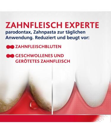 Parodontax Fluoride Toothpaste - 4x75ml | Prevent Bleeding Gums & Freshen Breath - Buy Internationally - Buy Online on GoSupps.com