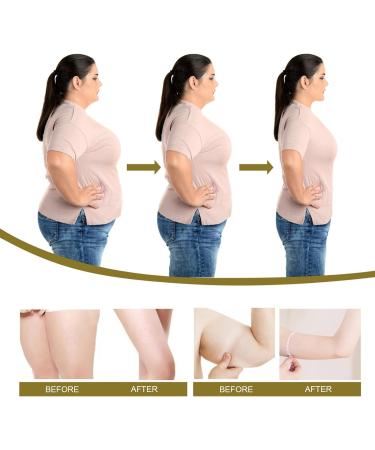 GGPM Bee Venom Slimming Nose Ring - Lymphatic Drainage & Firming 3 Pack for Weight Loss - Unisex - Buy Online on GoSupps.com