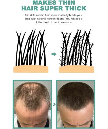 UOYOU Medium Brown Hair Fibres 27.5g Bottle - Natural Keratin Hair Loss Concealer for Men and Women - Hair Building Fibres Powder - Buy Online on GoSupps.com