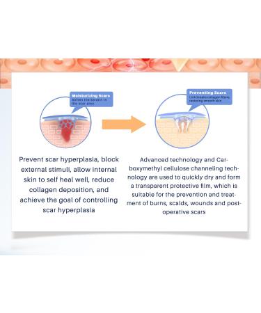 Advanced Scar Gel - Powerful Cream for Surgical, Burn, and Acne Scars - 30g - Buy Online on GoSupps.com