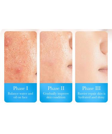 BIOAQUA Hyaluronic Acid & Vitamin B5 Facial Mask - Soothing Moisturizing & Nourishing - 30g x 5pcs - International Shipping Available - Buy Online on GoSupps.com