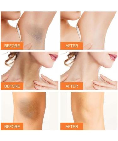 Body Whitening Cream for Women Under Arms Legs Knees Elbows and Private Parts Brightens Underarm Whitening Cream for Dark Spots Removal - Buy Online on GoSupps.com