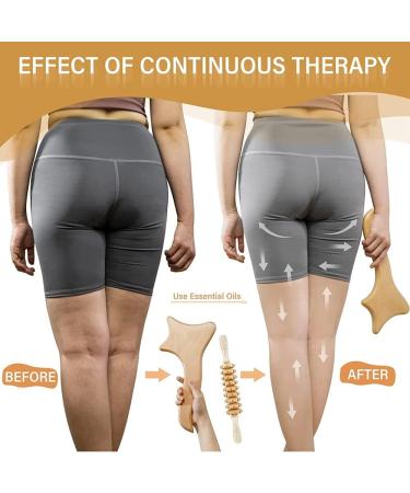 5 in 1 Maderotherapy Set - Anti-Cellulite Massage Device & Gua Sha Cup for Pain Relief & Skin Tightening - Buy Online on GoSupps.com