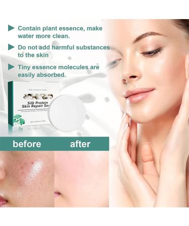  Chagoo Flysmus Silk Protein Melanin Fading Soap 60g Collagen Milk Whitening Soap Natural Skin Repair Facial and Body Soap (3pcs) - Buy Online on GoSupps.com