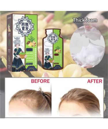 Ginger Plant Extract Anti-Hair Loss Hair Shampoo Ginger Extract Shampoo Smooth and Oil Control Nourishing Shampoo Ginger Hair Care Shampoo for Women Men - Buy Online on GoSupps.com