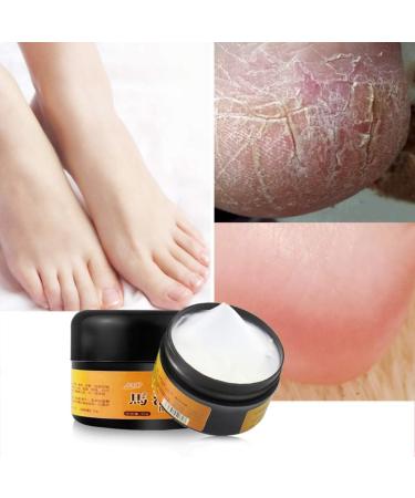 AllbestAye Foot Repair Skin Healing Cream for Thick Cracked Rough Dead Dry Skin Moisturizing Callus Care for FEET Elbows Hands Exoliating Foot Cream for Cracked Heels And Dry Feet 50g
