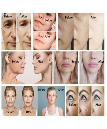 EGF Serum for Face - Brightening & Moisturizing Anti-Aging Treatment for All Skin Types - Reduces Wrinkles Hyperpigmentation & Dryness - For Face Neck & Chest - 1 fl oz - Buy Online on GoSupps.com