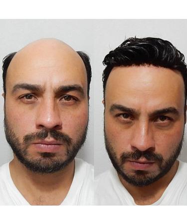 YANAHAIR Toupee for Men - Real Human Hair Replacement System - Fine French Lace Hairpiece - Customizable Hair Units - Natural-Looking Hair Pieces - Hair Prosthesis - #1 Jet Black - 8x10 - Buy Online on GoSupps.com