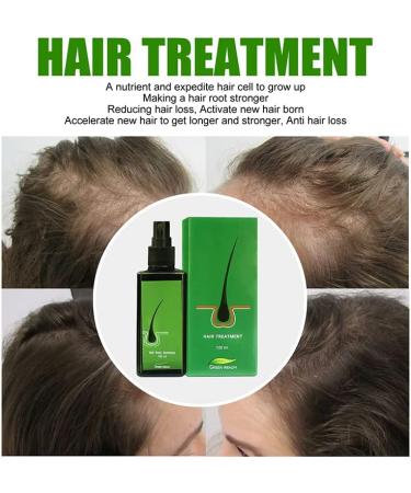 Hair Growth Serum for Men & Women - 120ml Hair Regrowth Lotion Anti Hair Loss Promotes Thicker Stronger Hair & Beard - 100% Natural Herbs - Buy Online on GoSupps.com