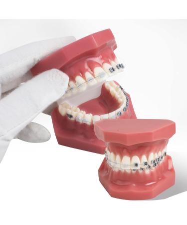 TM-208 Orthodontic Model Teeth - Study Tools with Metal & Ceramic Bracket (Red) for Effective Teaching | International Shipping Available - Buy Online on GoSupps.com