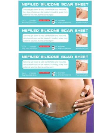 Professional Scar Remover Strips - Reusable Silicone Patch for Stretch Marks - 9.8ft Clear Concealed Sheets for Mild & No Irritating Scar Removal - Buy Online on GoSupps.com