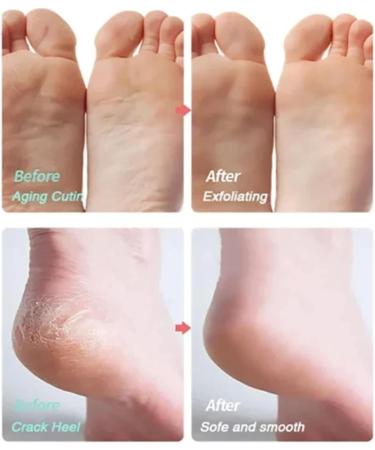 exfoliating foot mask extra long nourishing moisturizing foot mask moisturizing foot mask long leg moisturizing mask for men and women Jildouf - Buy Online on GoSupps.com