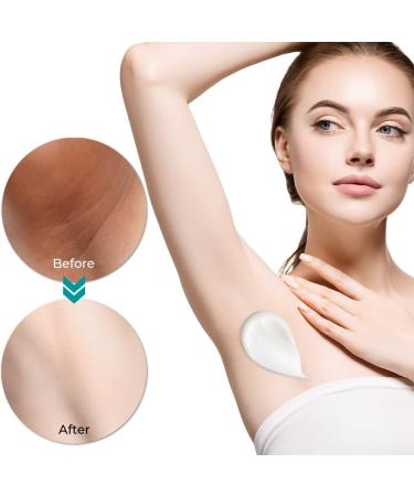 Skin Lightening Cream for Dark Spots & Hyperpigmentation - Underarms, Knees, Elbows, Inner Thigh, Bikini Area | Body Whitening & Bleaching Treatment - Buy Online on GoSupps.com