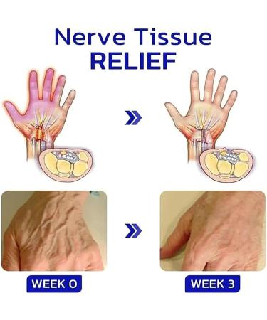 Numbfix Lot de 2 vaporisateurs pour mains et pieds pour l'inconfort caus par les articulations t nosynovite mains et pieds 2 Pi ces. - Buy Online on GoSupps.com