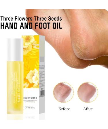 Hand And Foot Essence Oil Foot And Hand Massage Oil Hand And Foot Oil Moisturizing Hand And Foot Cream For Smoother Skin Hand And Foot Oil Repairs Chapped Moisturizing On Hands And Feet - Buy Online on GoSupps.com