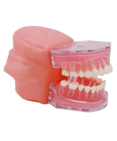 Dental Soft Gum Standad Typodont Study Model with 28 Removable Teeth & Cheeks - Ultimate Dental Training Tool - Buy Online on GoSupps.com