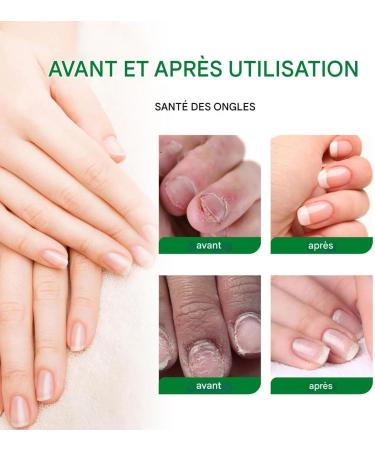  Raypontia Nail Cream - 20ml Intensive Strengthening Gel for Nails Moisturizing Care for Dry and Cracked Nails Men and Women Nighttime Use Shower Travel Home Sports - Buy Online on GoSupps.com