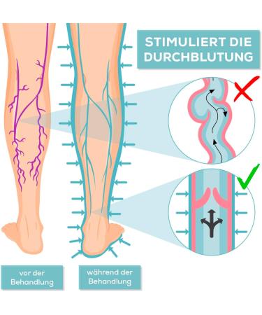 Venenwalker Pro2 Vein Therapy | Certified Medical Device for Venous Issues | Fast Relief for Thigh Problems - Buy Online on GoSupps.com