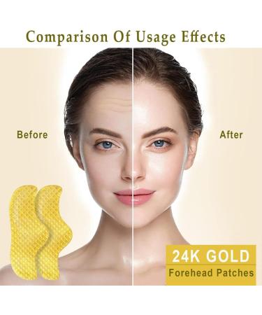 KlsyChry 24K Gold Hydrogel Patches for the Face Gold Forehead Mask Collagen Forehead Anti Wrinkle Patches Helps Smooth and Moisturize the Forehead 10 Pack - Buy Online on GoSupps.com