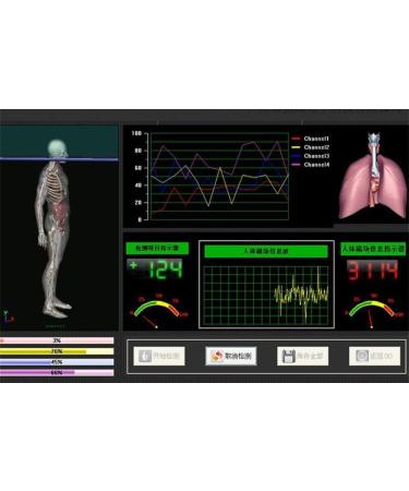 Jiahao Quantum Resonance Magnetic Analyzer - 49 Reports in German French & English | International Shipping Available - Buy Online on GoSupps.com