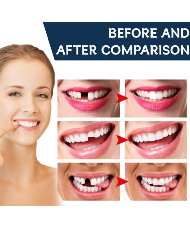 GNHG GMDP Selfapplied artificial teeth dental adhesive doityourself fillings to repair broken teeth 30 ml - Buy Online on GoSupps.com